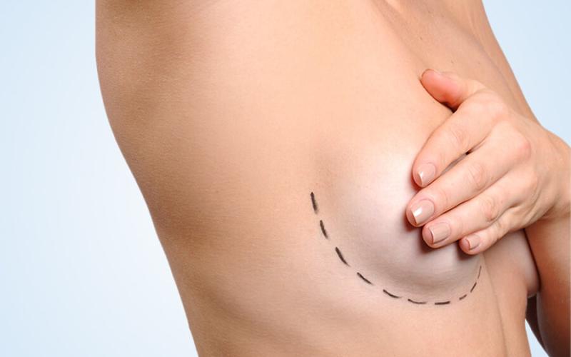 What Is the Breast Reduction Surgery Cost Dubai?